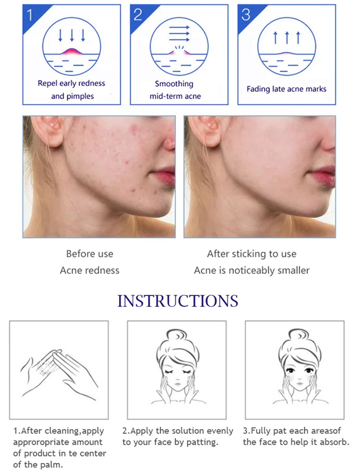 Anti-Acne Face Serum with Aloe Vera & Salicylic Acid for Skin Repair