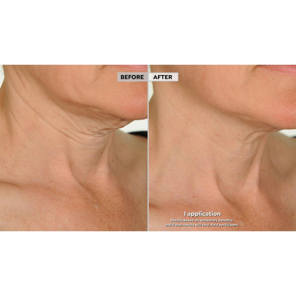 Face Tightening Serum with Instant Lift & Wrinkle Reduction - 1 Fl Oz