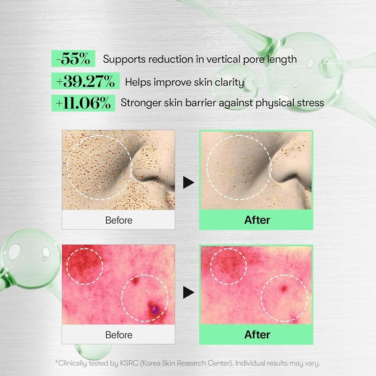 CICA Reedle Shot 100 Microneedling Serum Kit - 60ml & 30ml