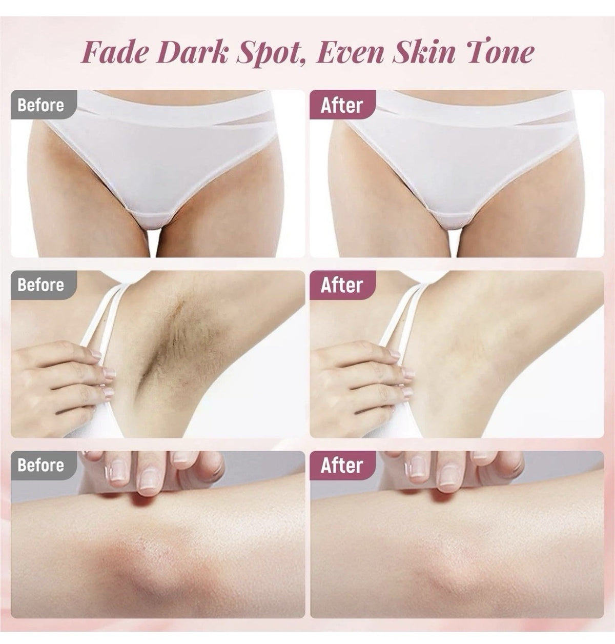 Skin Lightening Cream for Intimate Area Dark Spot Removal - Whitening Body Cream