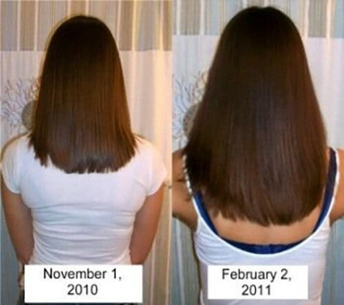 Hair Loss Treatment Butter Cream - 16 Organic Oils