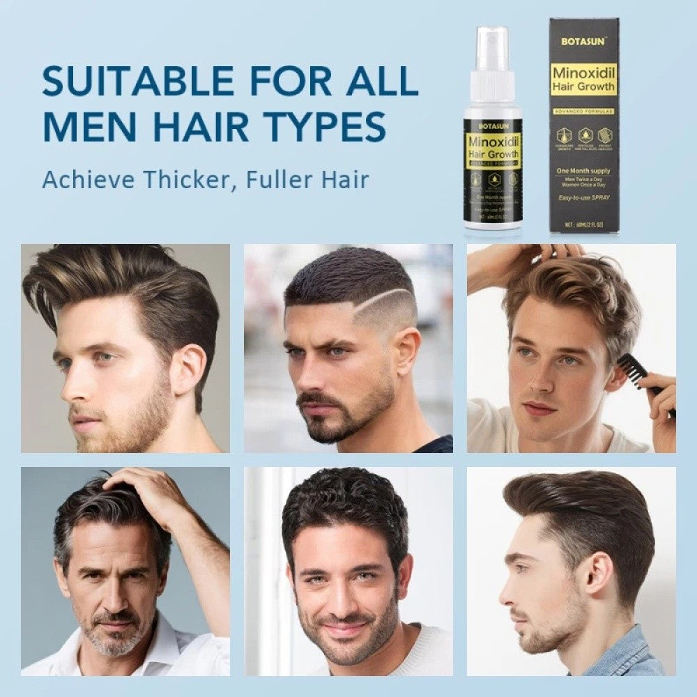 Hair Growth Spray for Men 60ml - 5% Minoxidil Regrowth Treatment