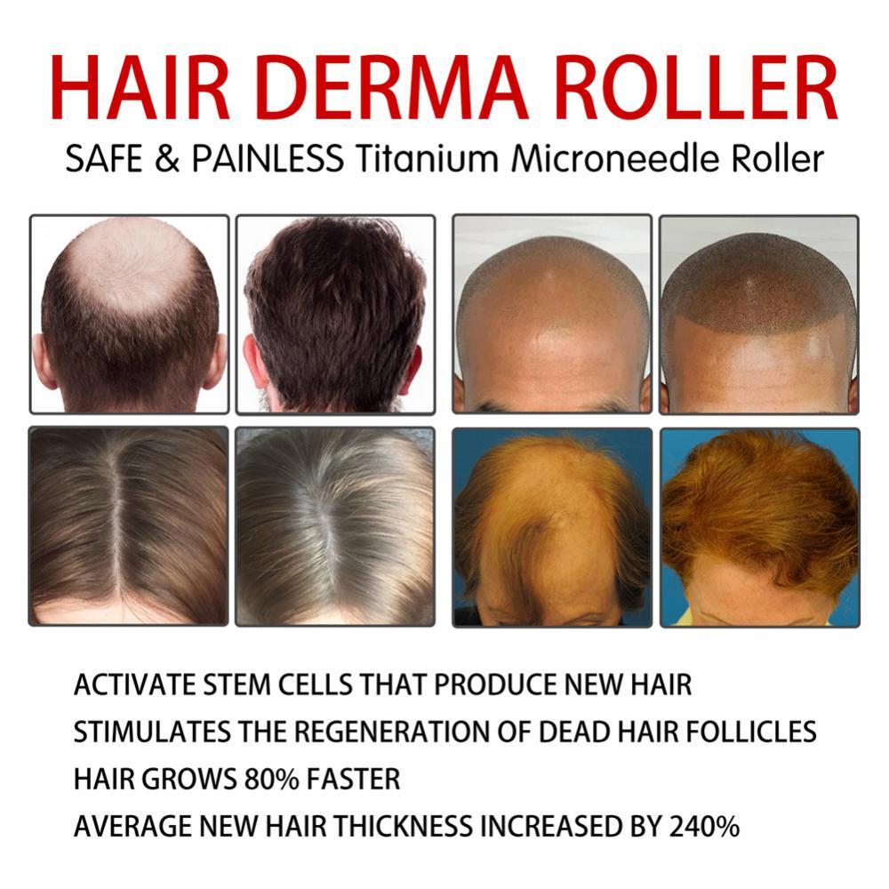 0.5mm Titanium Derma Roller for Hair, Beard & Skin Rejuvenation