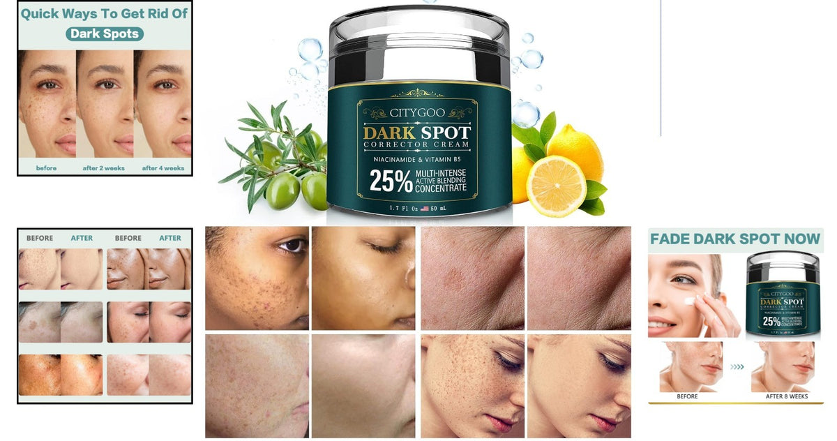 Dark Spot Corrector Cream for Hyperpigmentation & Uneven Skin Tone - 1.7 OZ