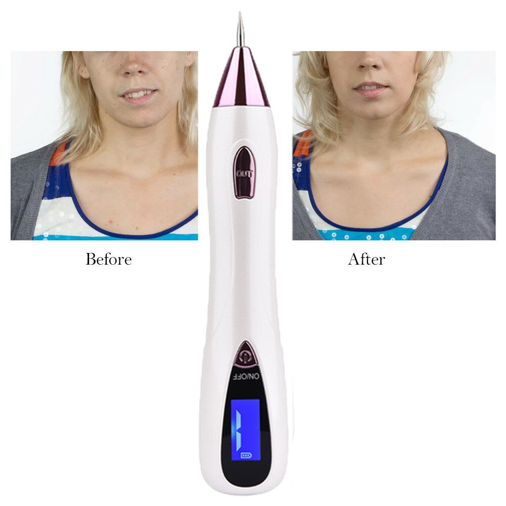 Fibroblast Plasma Pen for Skin Spot Removal, Wrinkle & Eyelid Lift