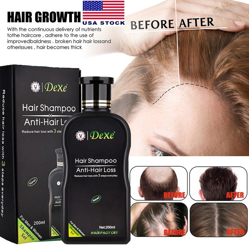 Anti-Hair Loss Shampoo 200ml - Herbal Treatment for Men & Women