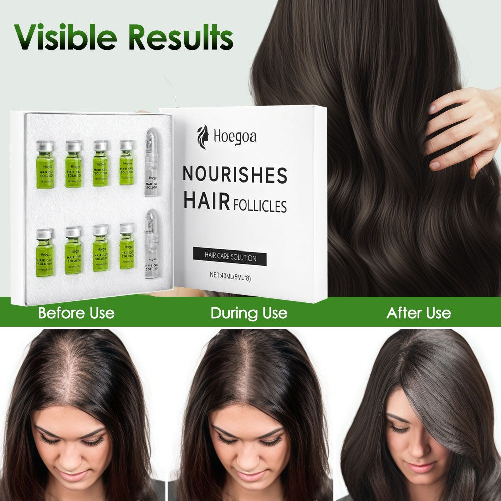 Hair Regrowth Serum Kit with Microneedle Roller - 8 Pieces