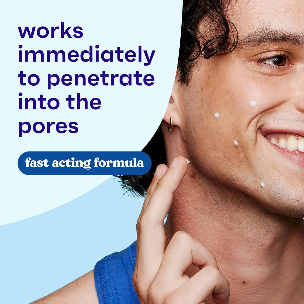 Maximum Strength Acne Spot Treatment Gel with 10% Benzoyl Peroxide - 1 oz, Cruelty-Free