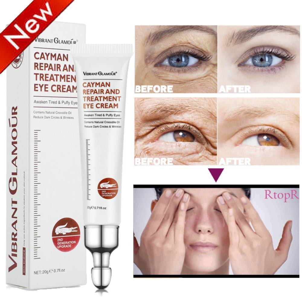 Collagen Retinol Eye Cream for Dark Circles & Wrinkles - 20g