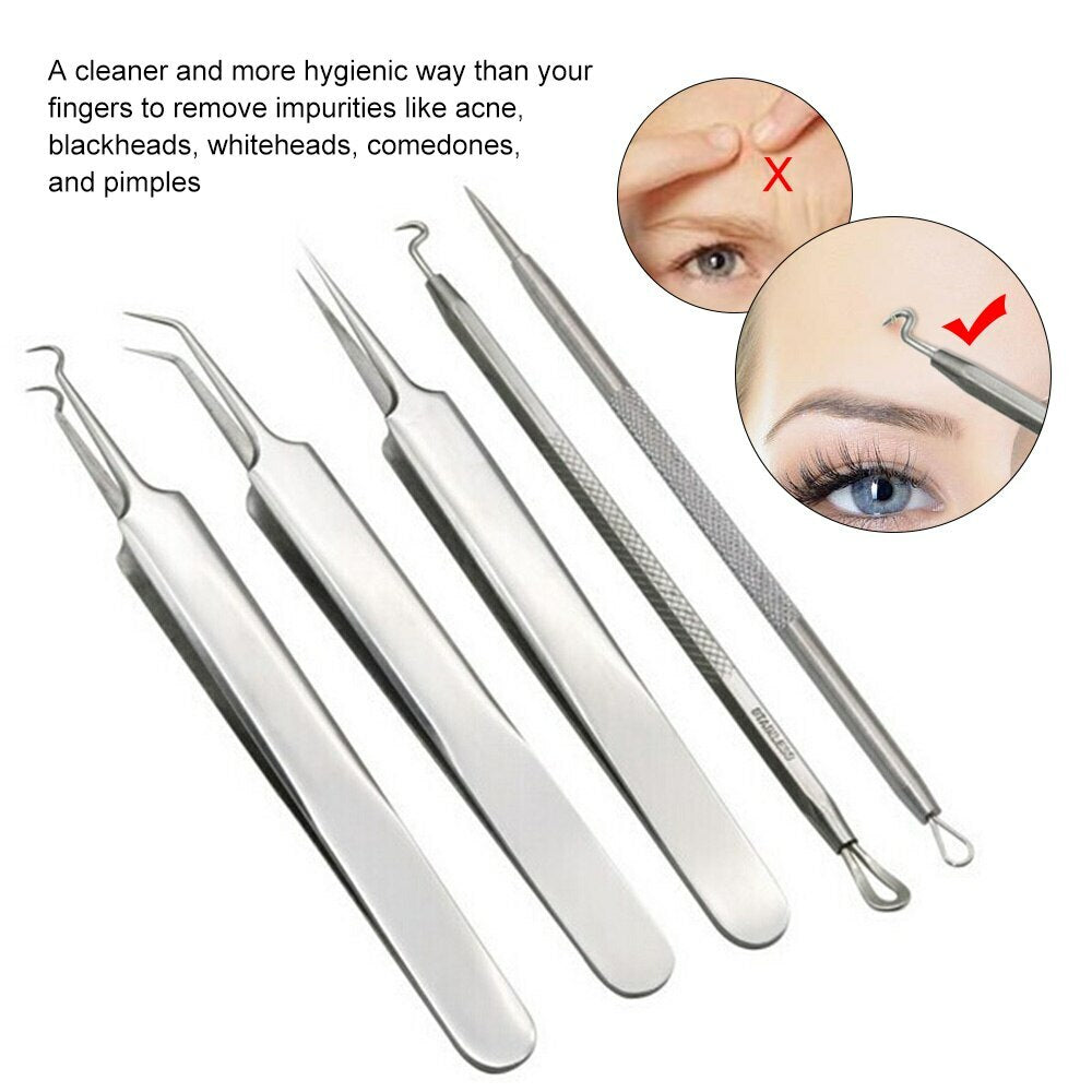 Blackhead and Acne Comedone Extractor Kit - Stainless Steel Pimple Remover with Tweezers & Case