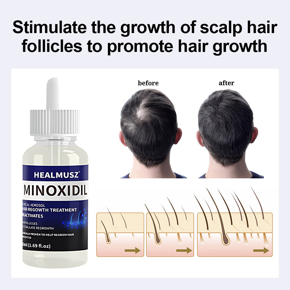 Minoxidil 5% Hair Regrowth Solution for Men - 100ml