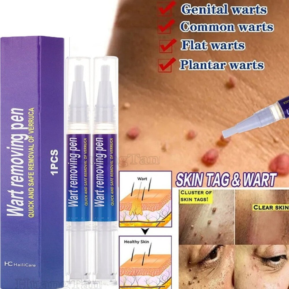 Herbal Wart Removal Pen for Hand, Foot, Flat & Filiform Warts - Set