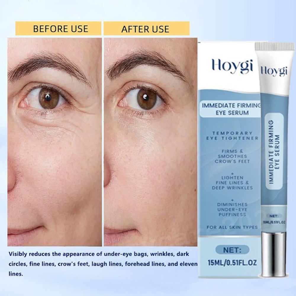 Anti-Aging Eye Cream for Dark Circles Puffiness Fine Lines 15ml