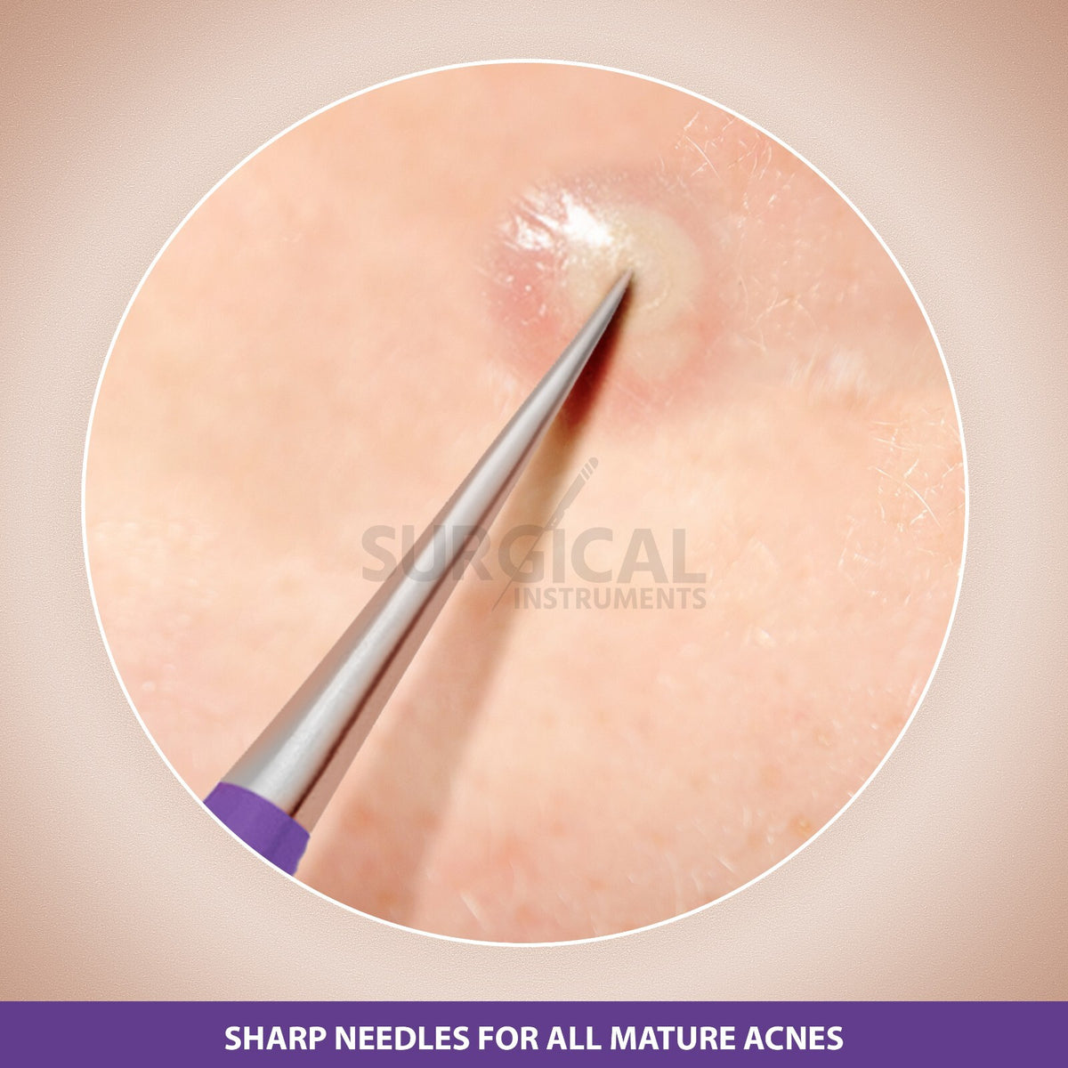 Pimple Popper Tool Kit - Blackhead Remover Set for Acne Extraction
