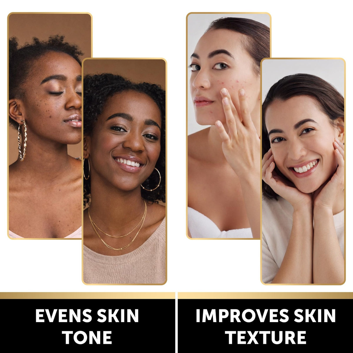 Brightening Lemon Turmeric Kojic Acid Bar Soap Pack of 5 - Clarify & Illuminate Skin