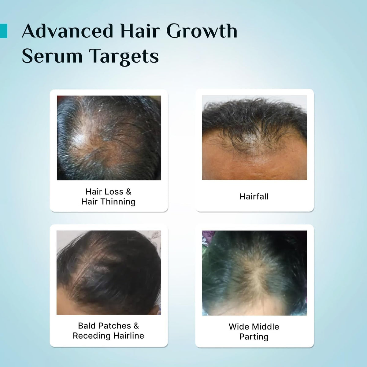Revitalizing Hair Growth Serum with Redensyl - Thicker, Fuller in