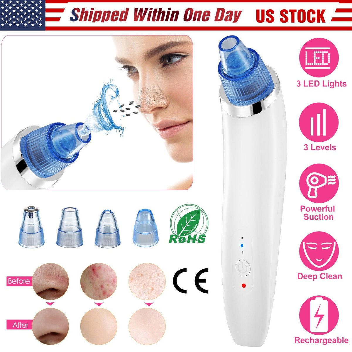 Electric Blackhead Remover Vacuum Pore Extractor with 4 Probes - USB Rechargeable