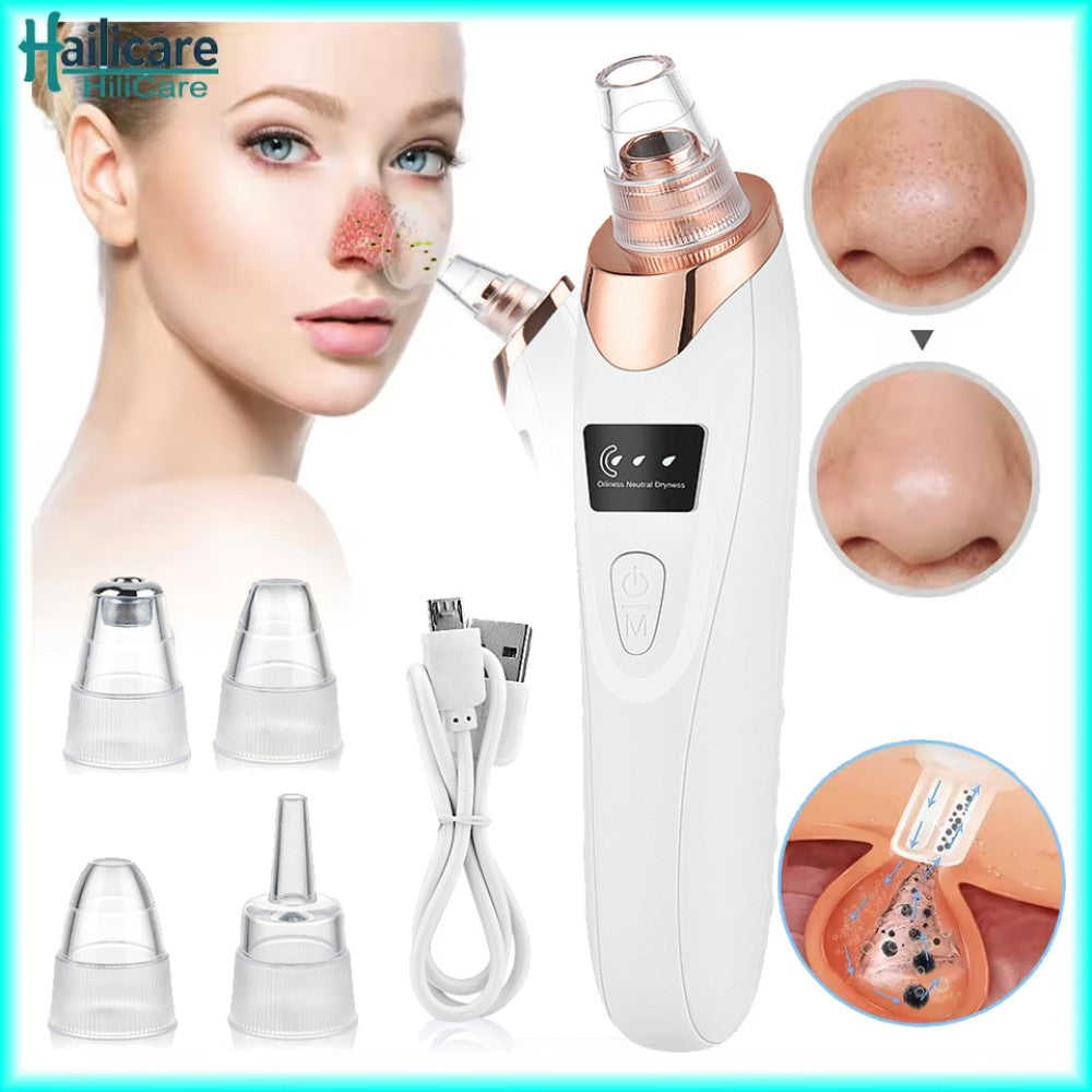 Electric Blackhead Remover Vacuum Pore Cleaner for Face – 5 Suction Heads, USB Rechargeable
