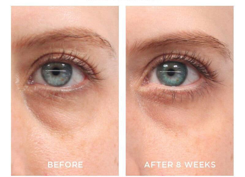 Anti-Aging Retinol Vitamin A Serum for Face - Fine Lines & Wrinkles Treatment