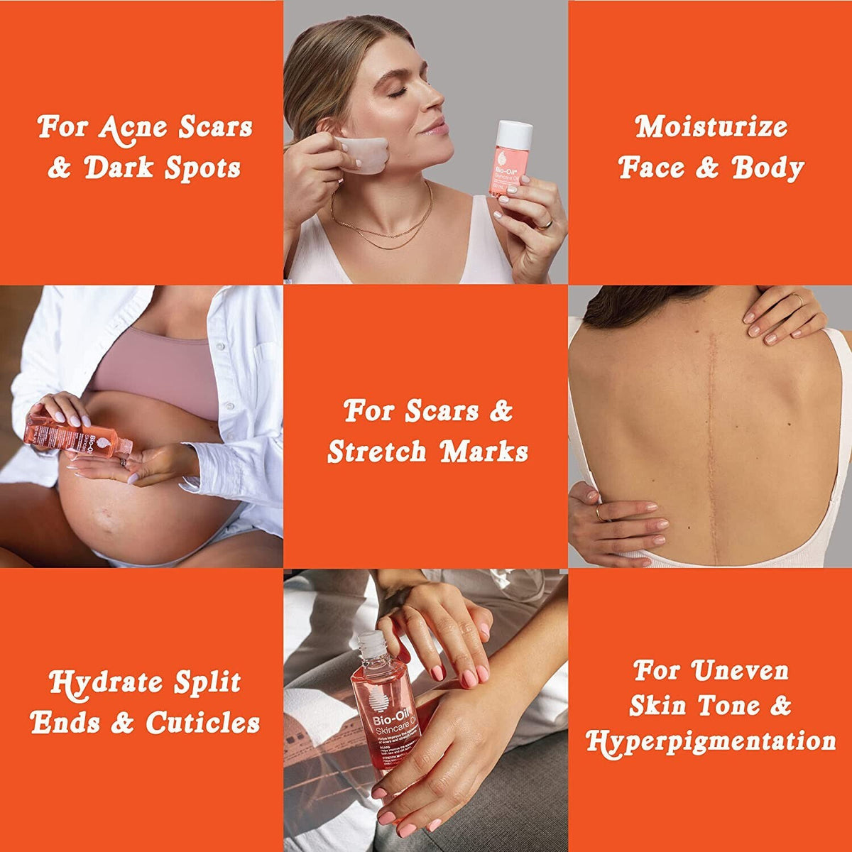 Bio-Oil Skincare Oil 6.7 oz Vitamin A E Scar Stretch Mark Dry Skin