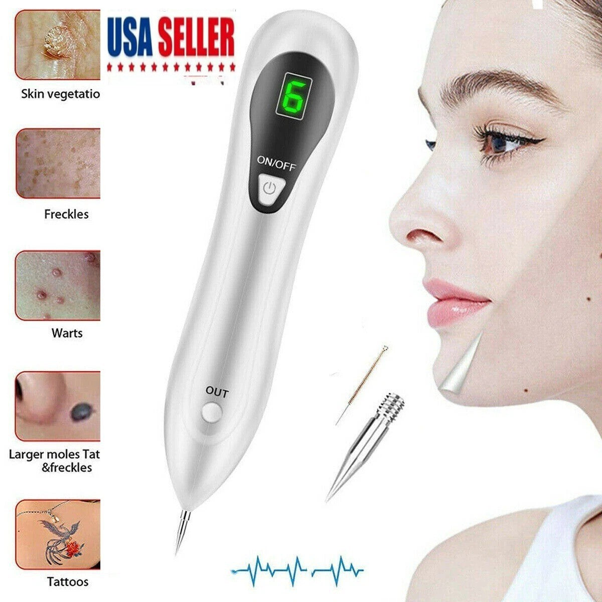 Electric Plasma Pen Mole and Skin Tag Remover for Dark Spots Warts Tattoo