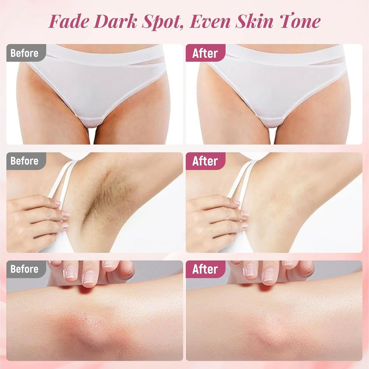 Skin Lightening Cream for Sensitive Areas 4 Pack - Dark Spot Remover & Brightening