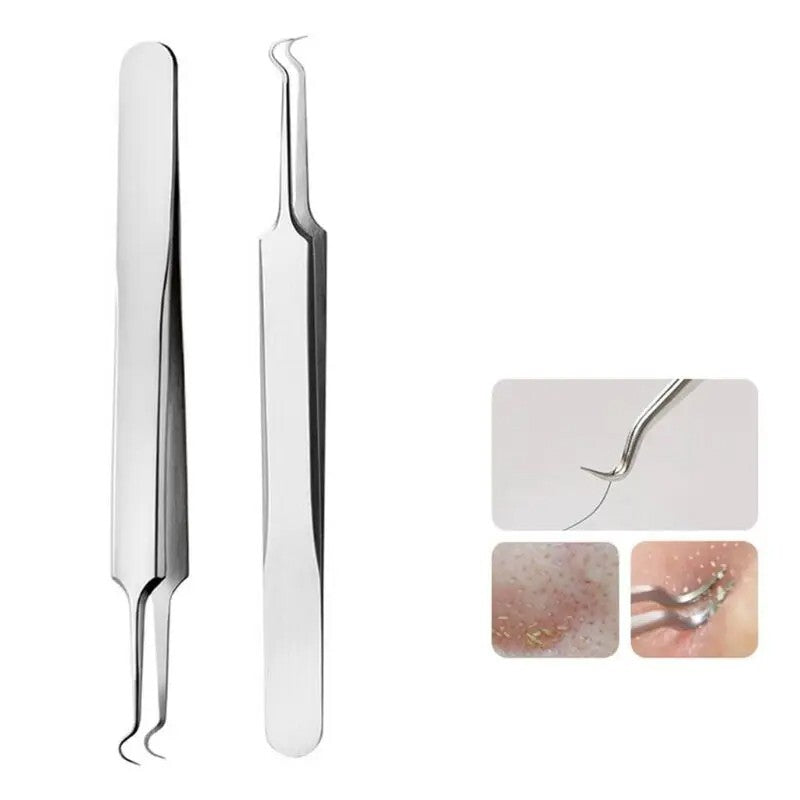 Blackhead Remover Tweezers - Curved Stainless Steel Pimple Extractor Tool