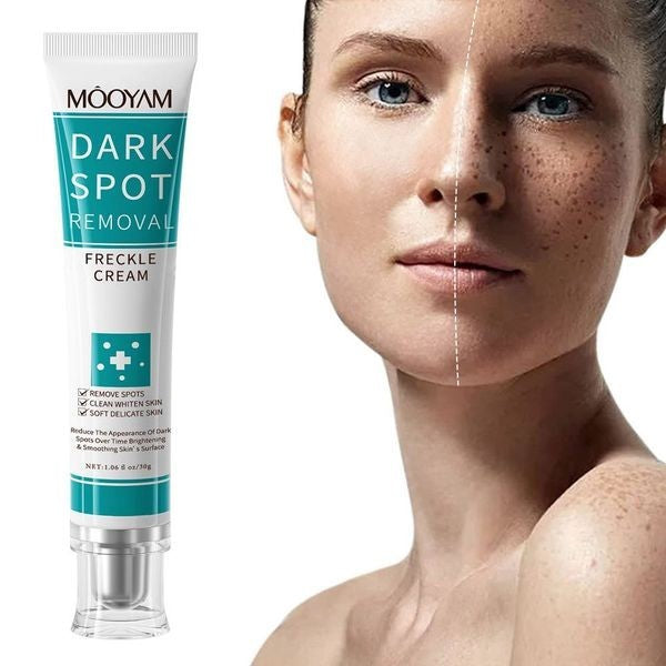 Dark Spot Remover Cream for Face & Body - Anti-Aging & Hyperpigmentation Treatment - 2 Pack