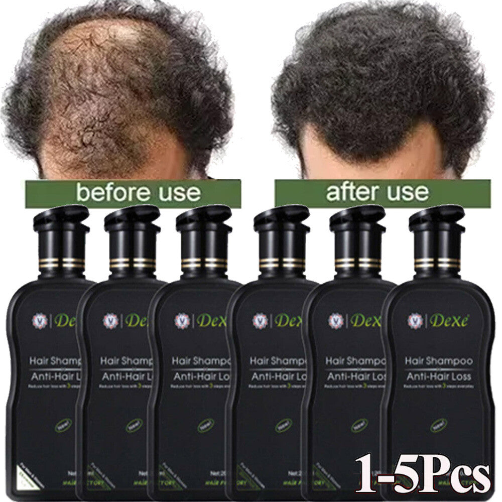 Anti-Hair Loss Shampoo for Hair Growth & Thickening - 200ml