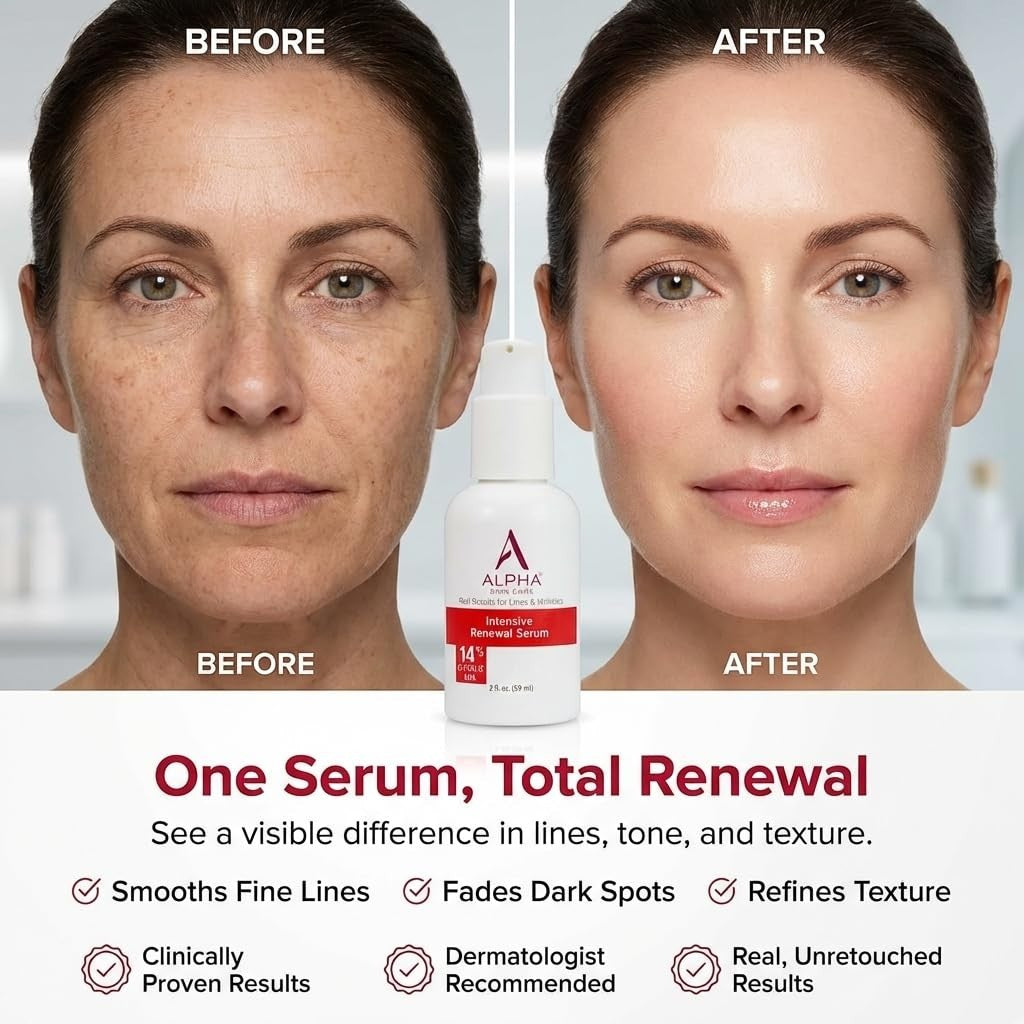 Alpha Skin Care Renewal Serum with 14% Glycolic AHA - 2oz, Pack of 3