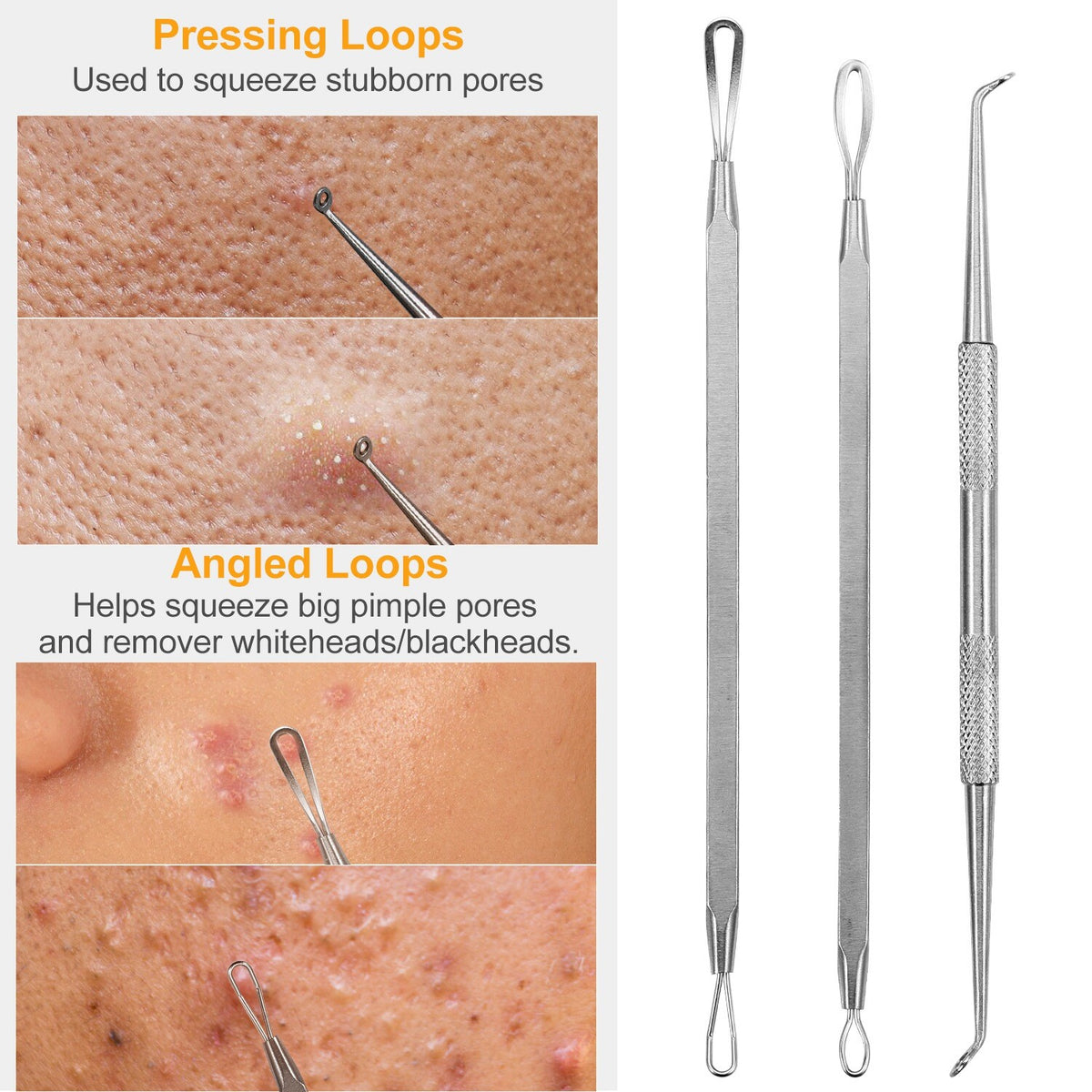 7Pcs Blackhead Remover Kit Stainless Steel Comedone Acne Extractor Tools