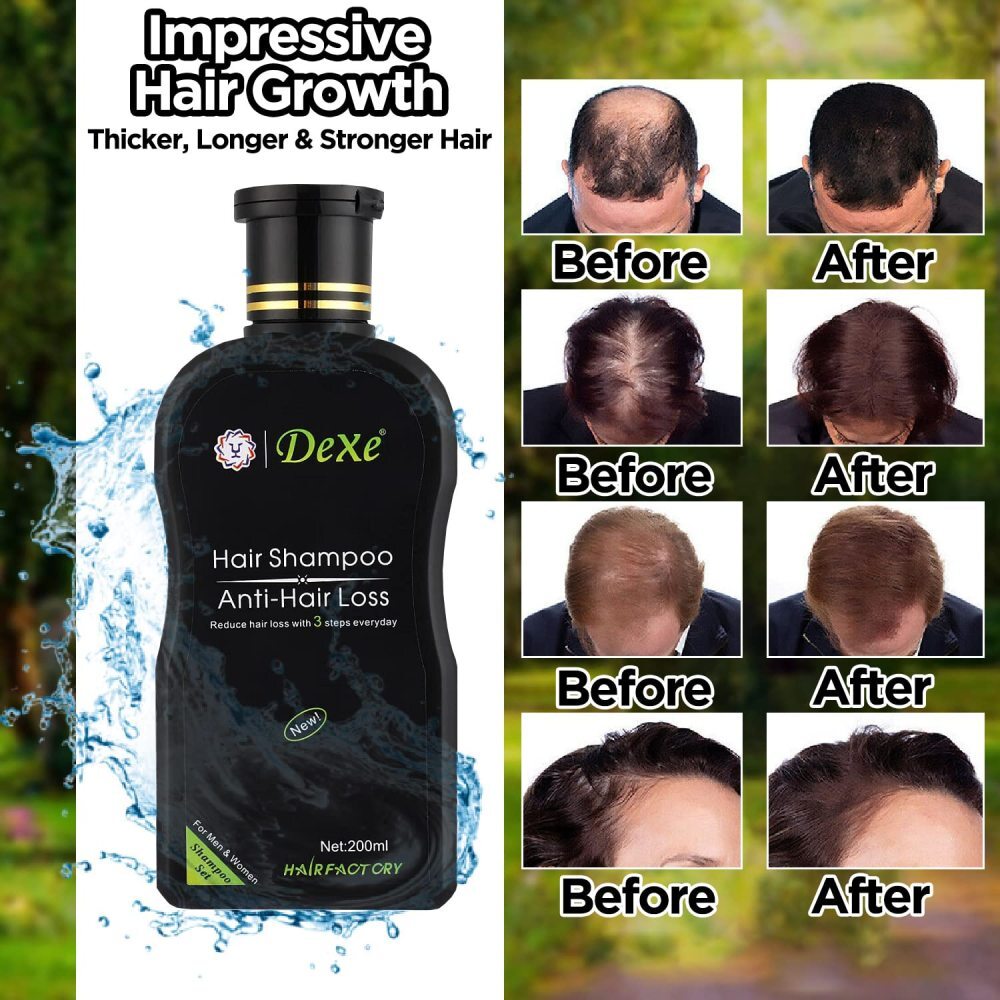 Herbal Hair Growth Shampoo Anti-Hair Loss Treatment for All Hair Types