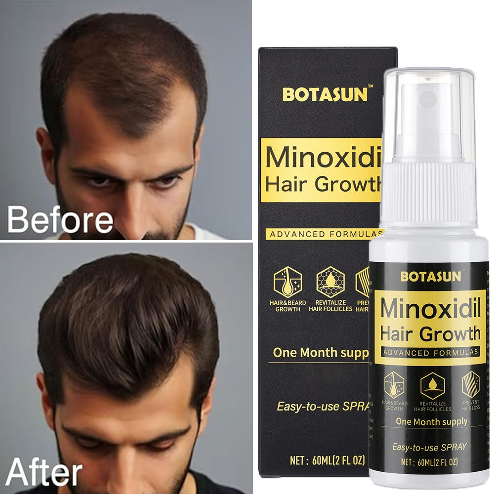 5% Minoxidil Hair Growth Spray for Men - 60ml
