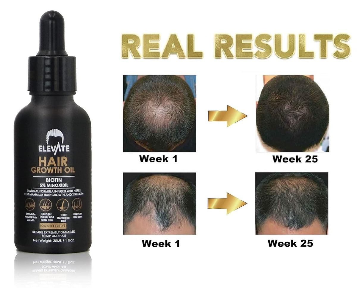 5% Minoxidil For Men and Women Hair Growth Serum, Regrowth Treatment