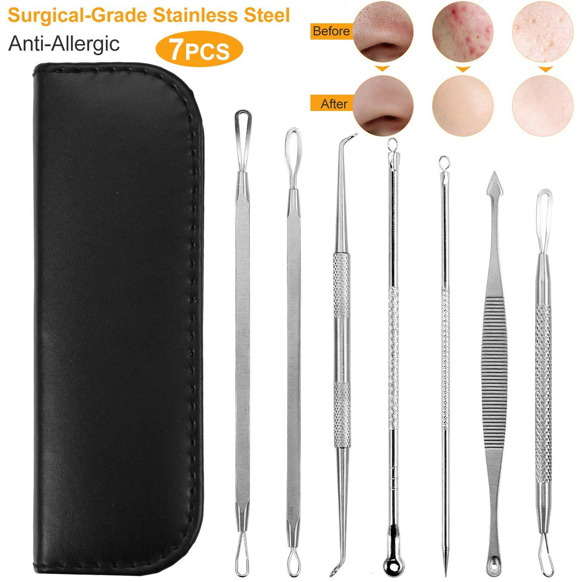 7Pcs Blackhead & Acne Comedone Extractor Tool Kit - Stainless Steel Pimple Remover Set
