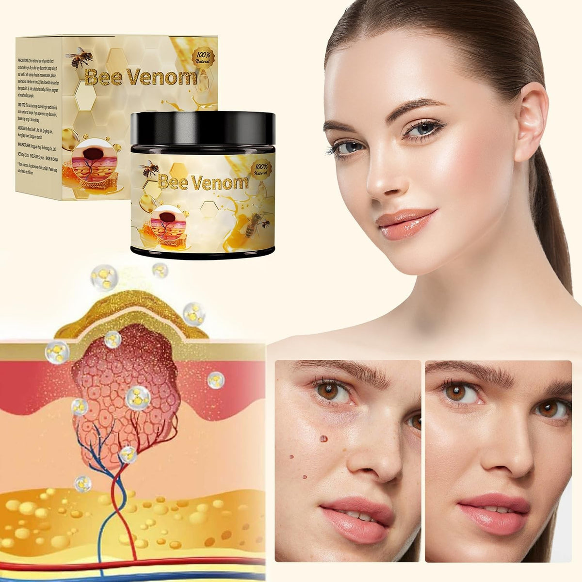 Bee Venom Treatment Cream Pack - Natural Skin Repair for All Body Parts