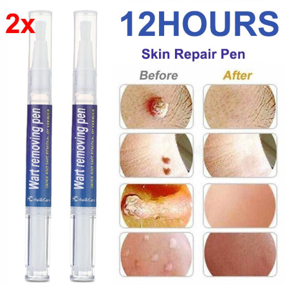 Skin Tag & Wart Remover Pen - Painless Natural Herbal Solution, 5ML, 2 Pack