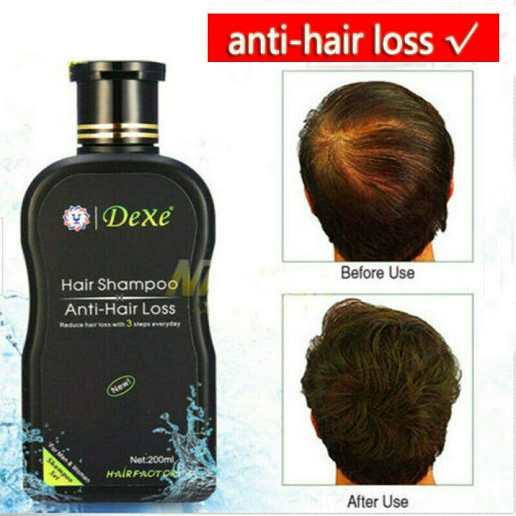 Anti Hair Loss Shampoo - 200ml Herbal Regrowth Treatment