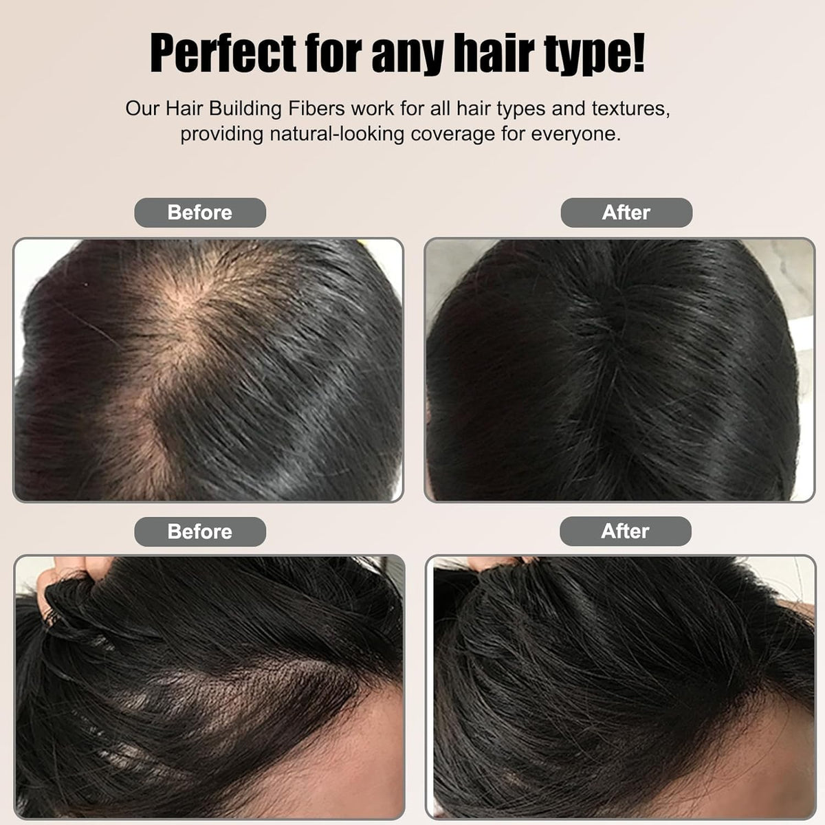 Hair Thickening Fibers for Thinning Hair - Men & Women