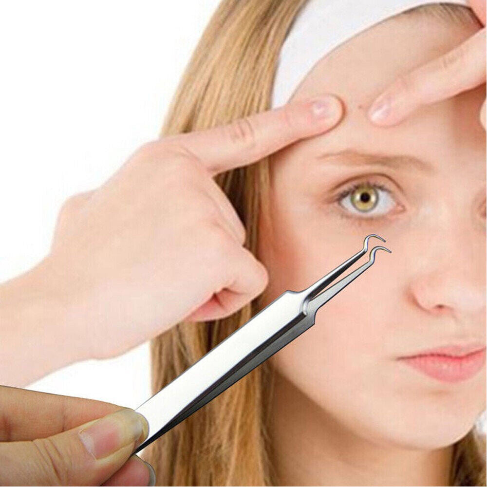 Blackhead Remover Tweezers Set - Pimple Blemish Extraction Tools