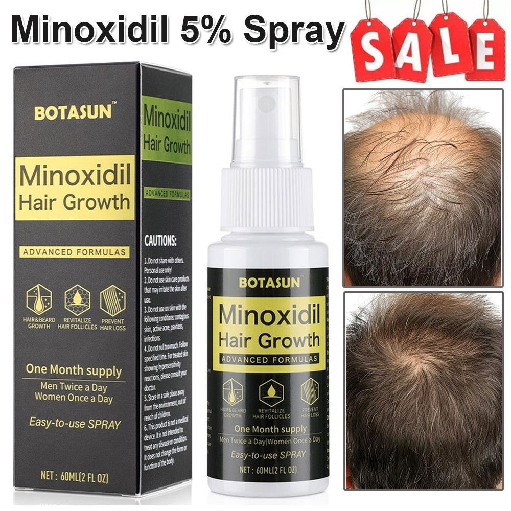 5% Minoxidil Hair Regrowth Spray for Men - 3 Month Supply