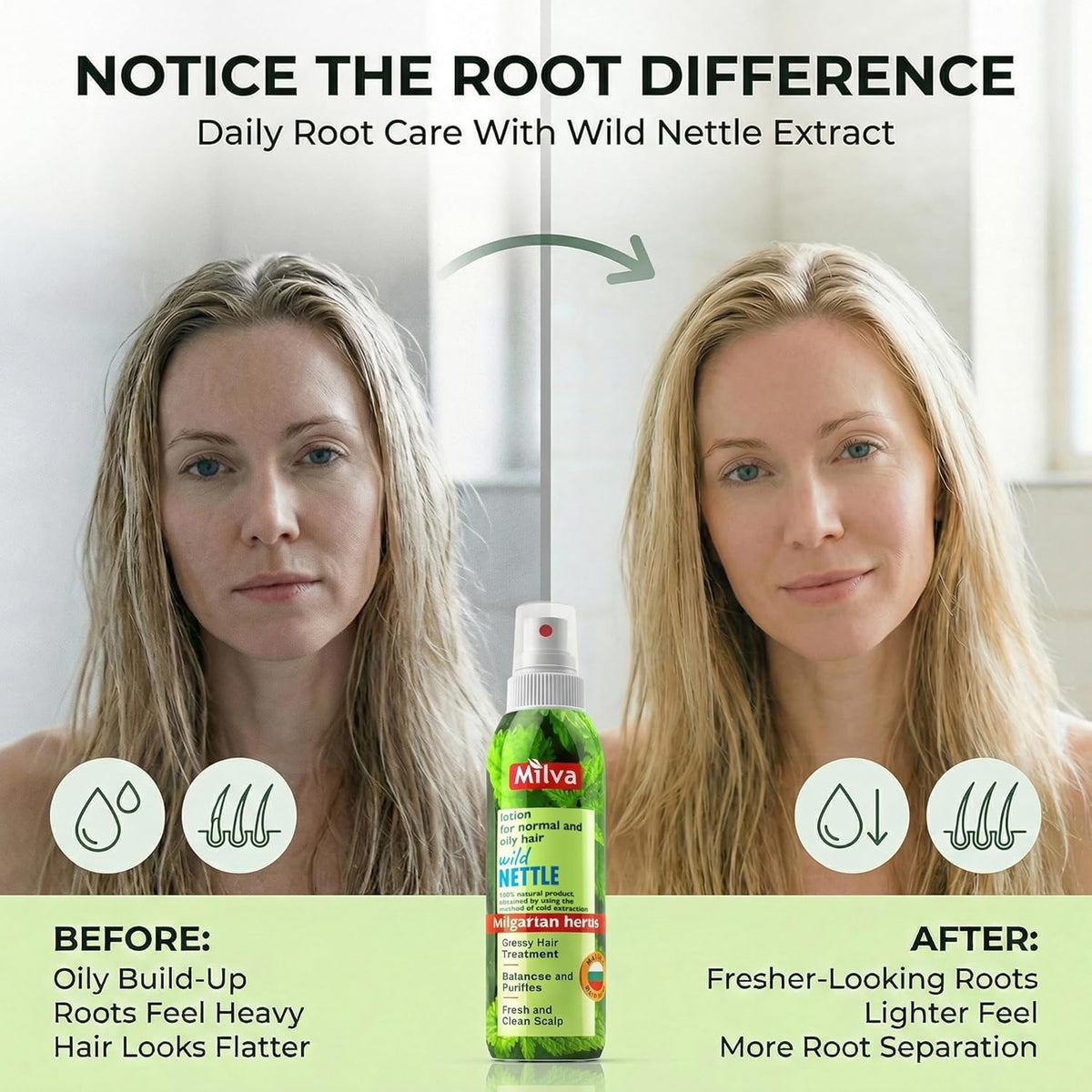 Nettle Extract Hair Tonic for Oil Control & Hair Strengthening - Sebum Regulating Lotion