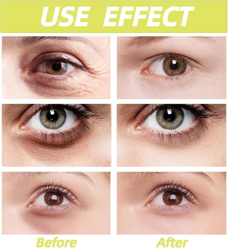 15g Anti-Aging Retinal Eye Cream for Wrinkle Reduction & Firming