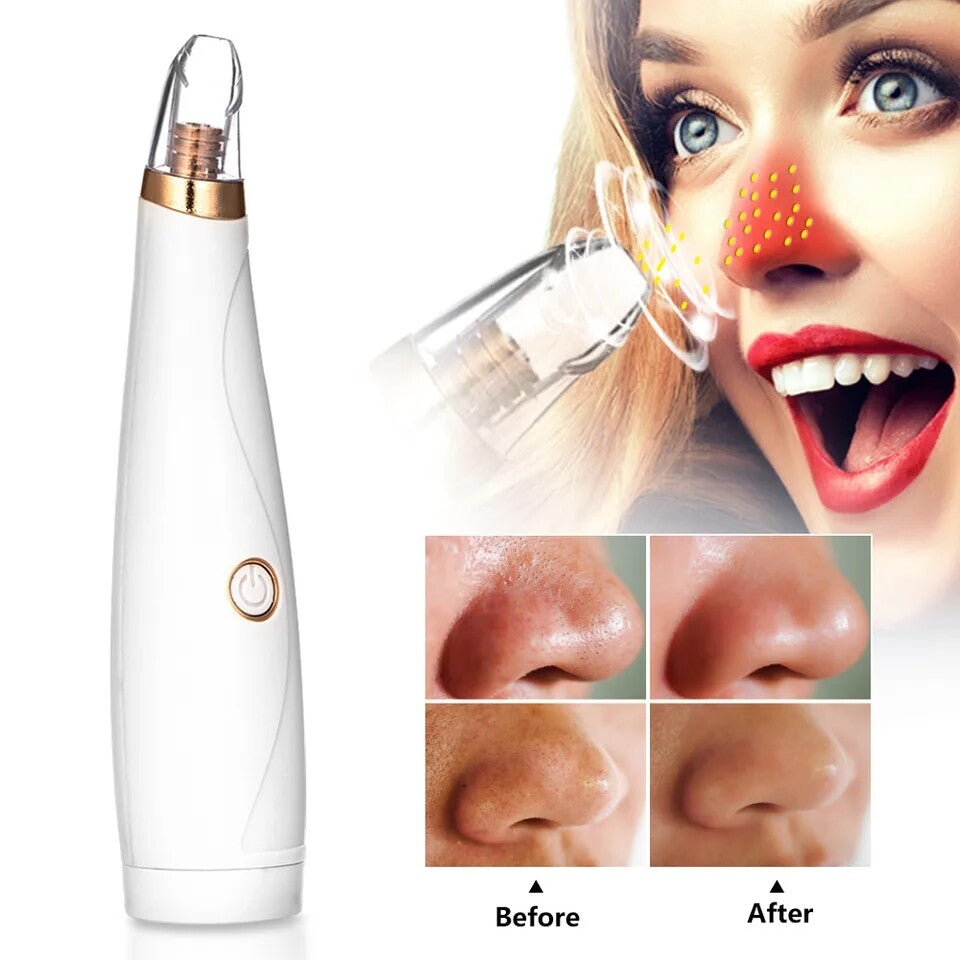 Blackhead Remover Vacuum Pimple Extractor for Acne and Comedones