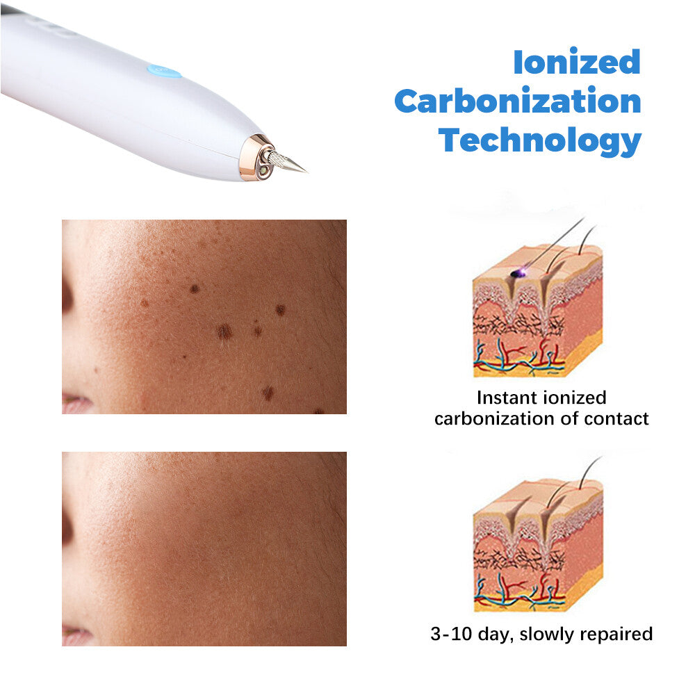 Laser Skin Tag Remover Pen for Mole Wart Freckle Dark Spot Removal