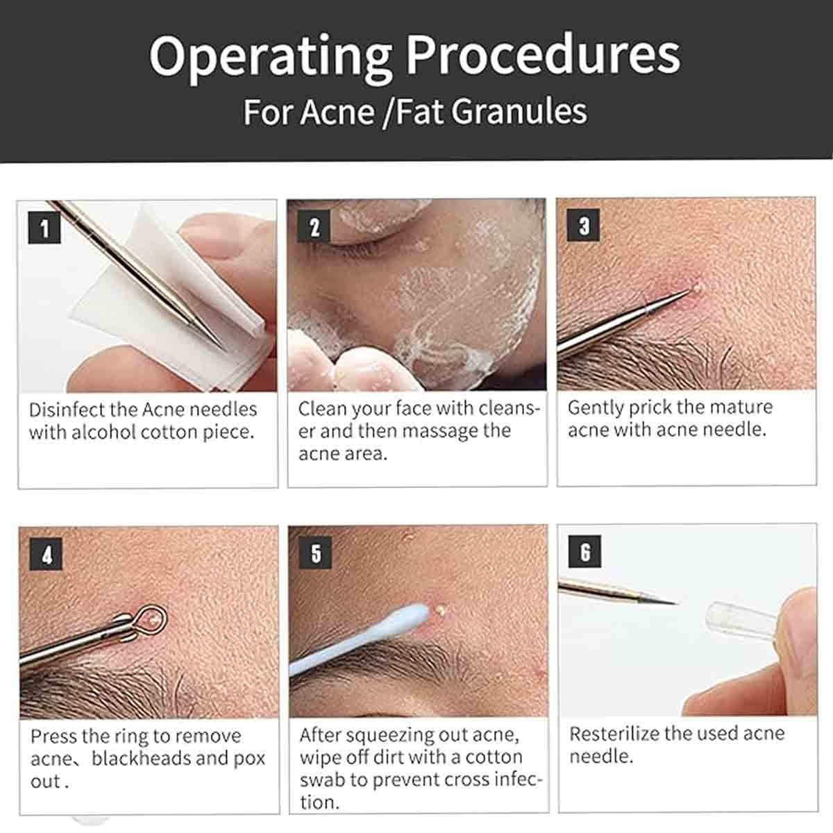 Blackhead Removal Tool Set - 9-Piece Acne Pimple Extractor Kit with Leather Case