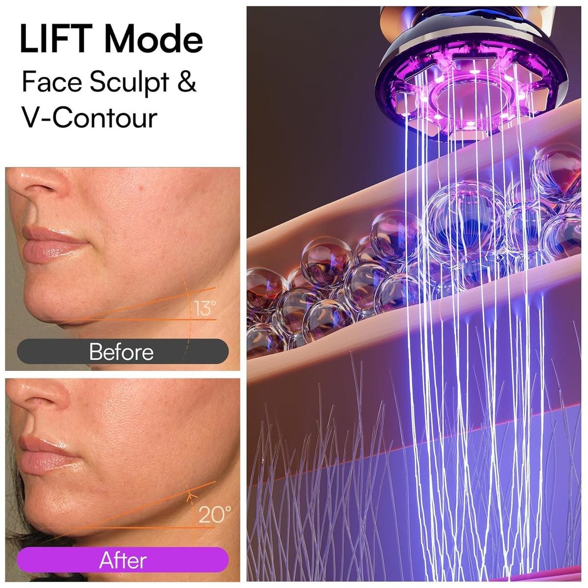 3-in-1 Microcurrent Facial Device with Red Light Therapy for Face and Neck