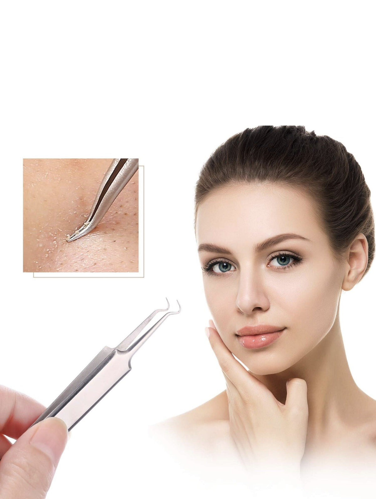 3-Piece Blackhead Remover Kit - Pimple & Acne Extraction Tools Set