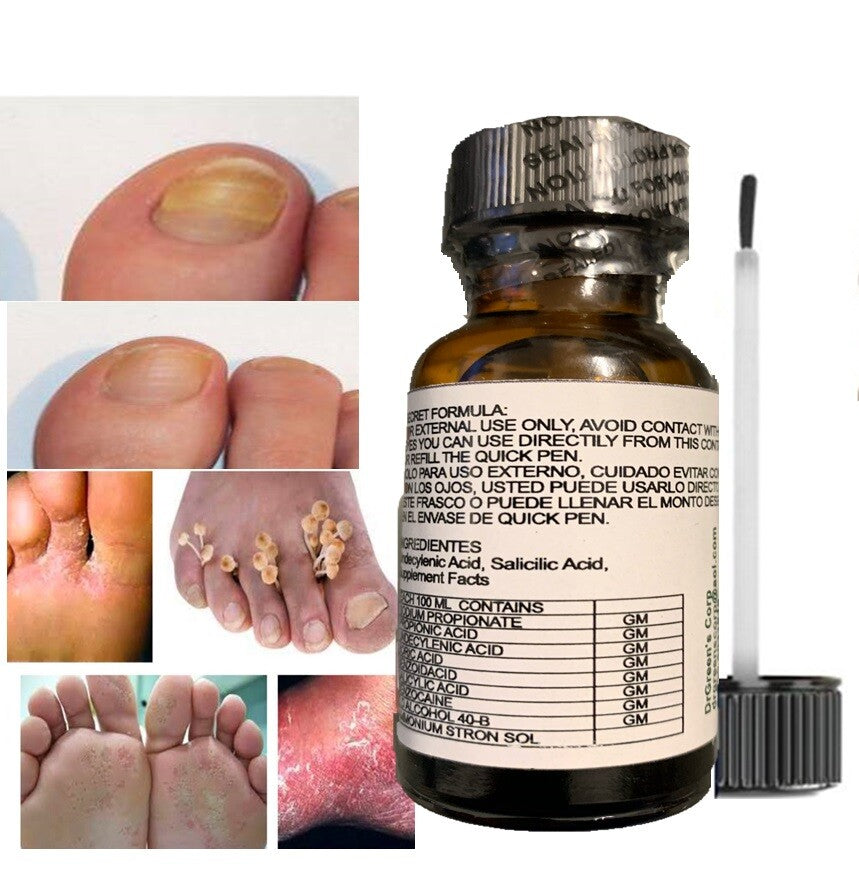 Anti-Fungal Support Gel for Toenails - Natural Nail Strengthener Duo