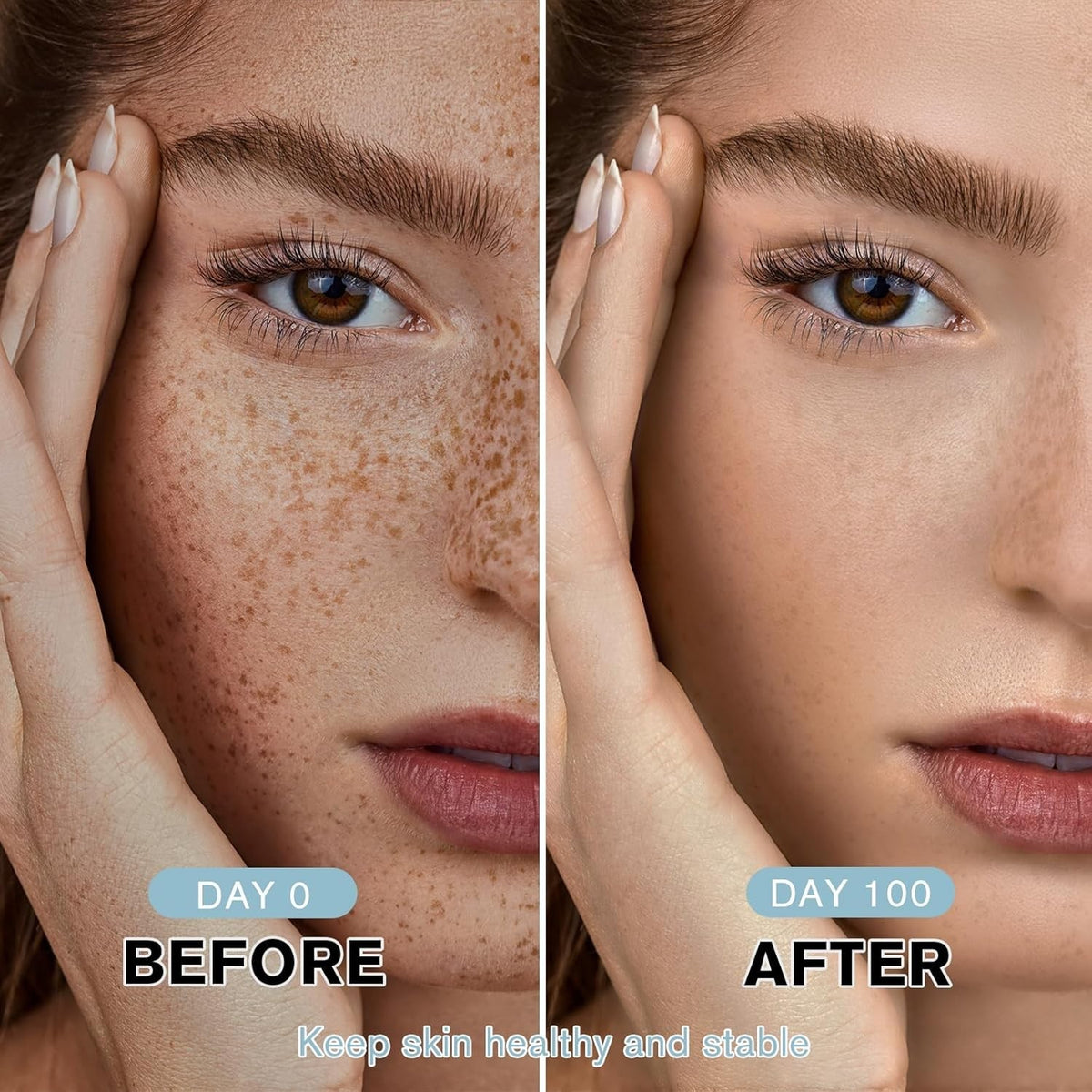 Dark Spot Corrector Cream for Face and Body Sun Spots - Unbranded